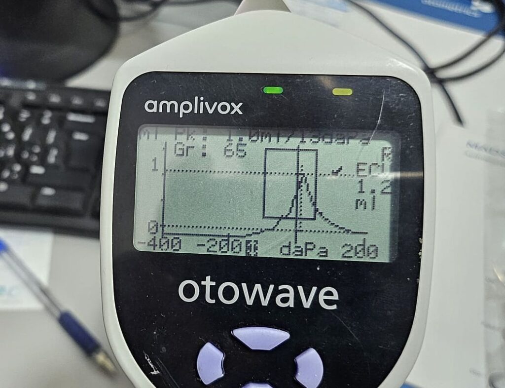 Eardrum pressure measurement device