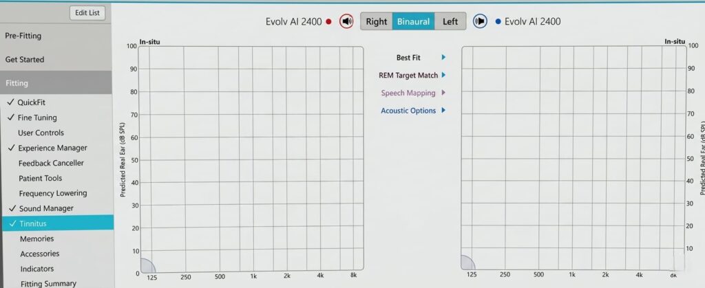 Tinnitus treatment using a hearing aid